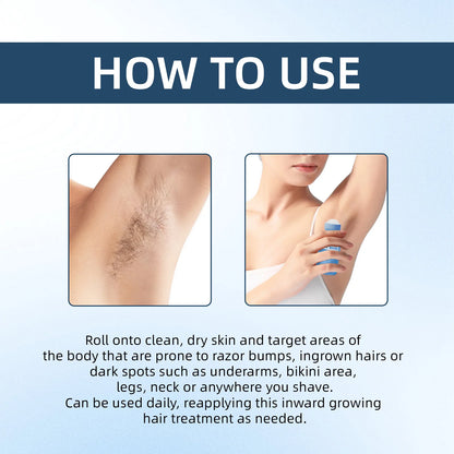 Rarify's Smoothing Solution | Ingrown Hair Treatment