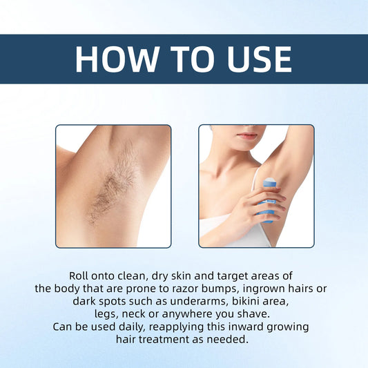 Rarify's Smoothing Solution | Ingrown Hair Treatment