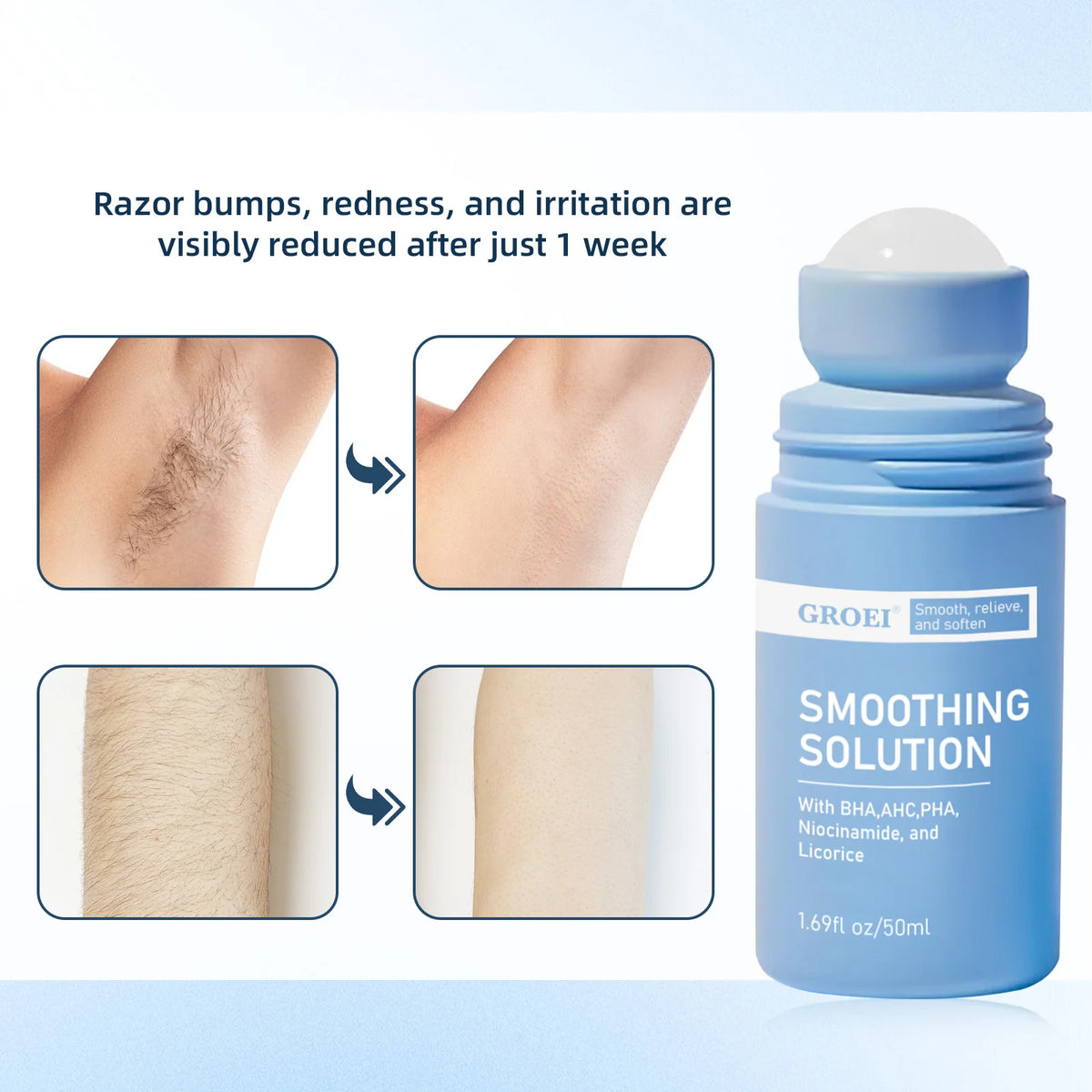 Rarify's Smoothing Solution | Ingrown Hair Treatment