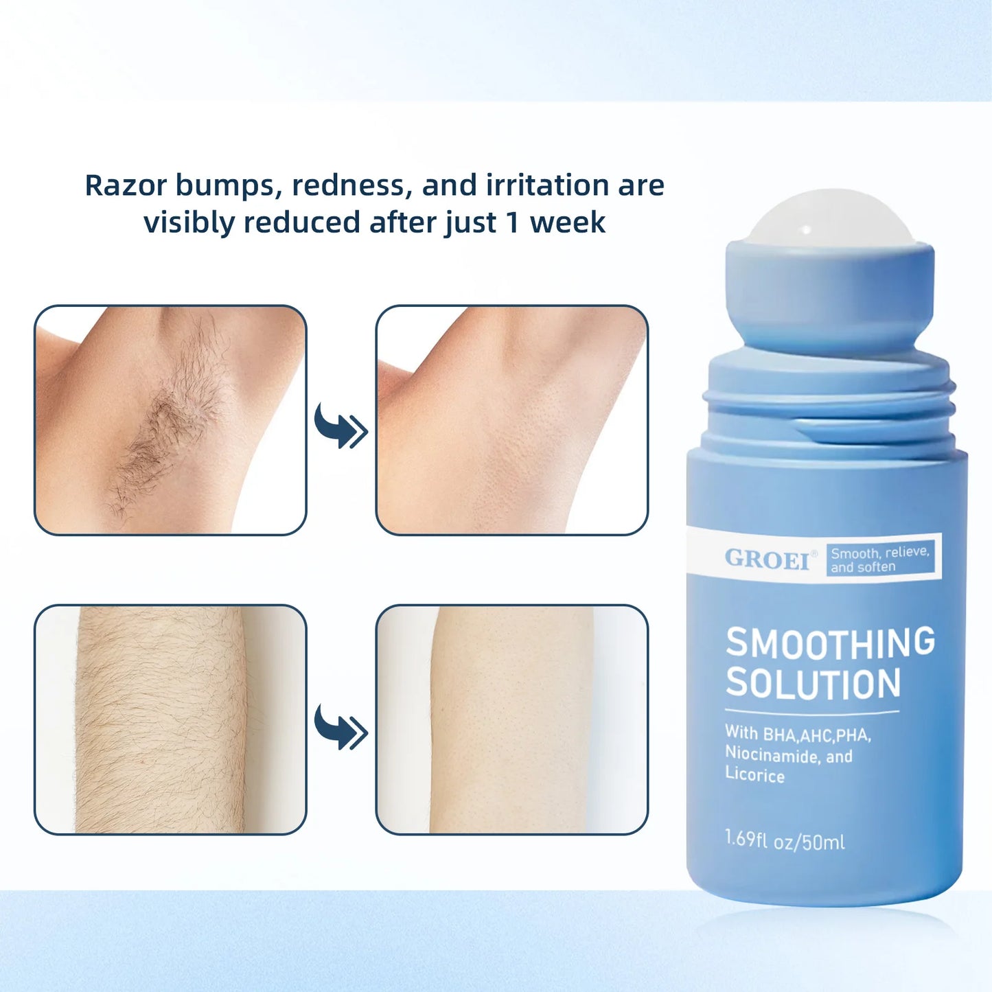 Rarify's Smoothing Solution | Ingrown Hair Treatment